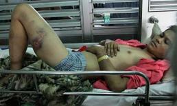 Nghi con gái bị “hại đời”, cả gia đình hành hung dã man một thanh niên