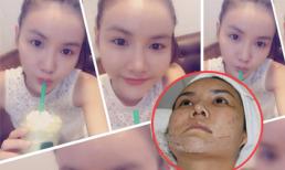 Anh Thúy tự tin khoe mặt trắng mịn tựa Ngọc Trinh sau "dao kéo"