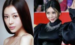 9 mỹ nhân càng phẫu thuật thẩm mỹ càng... xuống sắc