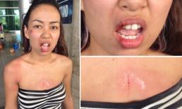 Đến lượt Thảo Trang bị cướp giật, ngã bầm dập mặt mày