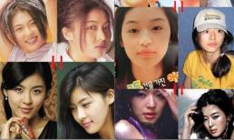 Lộ ảnh xấu xí trước khi thẩm mỹ của loạt sao đình đám xứ Hàn