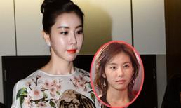 Sốc trước khuôn mặt sưng, cứng đơ của mỹ nhân "Ngôi nhà hạnh phúc"