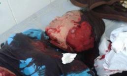 Bố chồng chém con dâu vì... đưa mẹ đi viện