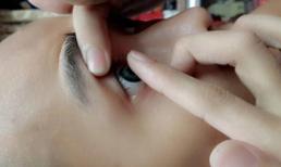 Cẩn trọng khi sử dụng kính áp tròng