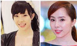 ‘Cá sấu’ Quỳnh Nga: cắt mí rồi gọt cằm?