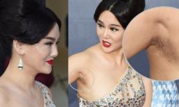 Sao nữ "mặt gãy" lộ "vùng cánh" thâm đen thậm xấu