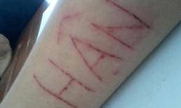 Lạ lùng những kiểu khoe "dị" trên Facebook