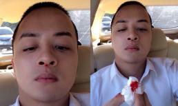 Cao Thái Sơn chảy máu mũi khiến fan lo lắng