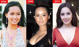 Mỹ nhân Việt trước và sau nghi án nâng ngực