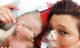 Bé sơ sinh đáng thương có hai khuôn mặt