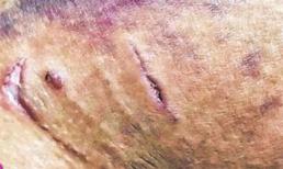 Con trăn dài 2m cuộn trong bồn cầu tấn công người