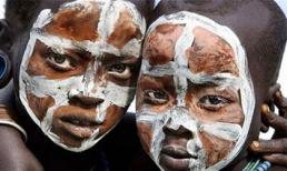 Hãi hùng với cách làm đẹp đau đớn 