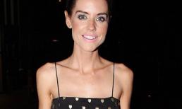 "Sốc" với bờ vai nhọn hoắt, xương xẩu như "xác khô" của sao nữ người Anh