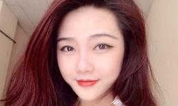 Lộ diện thêm hình ảnh của cô gái xinh đẹp bị "mất răng do cắn cướp"