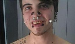 Sốc với chàng trai làm đẹp bằng cách... 'khoét da đục thịt'