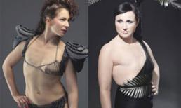 Bị cắt bỏ một bên ngực vẫn tự tin diện áo tắm