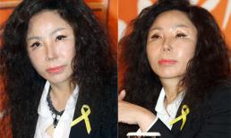 "Sốc" với gương mặt 'biến dạng' thẩm mỹ của diva xứ Hàn