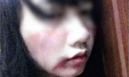 Lỡ miệng chửi thề, gái xinh bị "đầu gấu" đánh bầm mặt