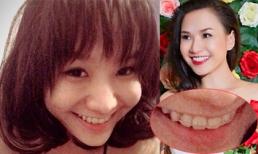 Vợ Baggio niềng răng, tự nhận xuống tóc trông như "con dở"