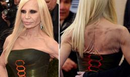 Sao già "gây choáng thảm đỏ" bởi nhan sắc phẫu thuật thẩm mỹ lỗi