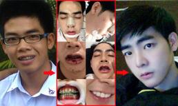 Theo chân chàng trai Thái Lan 19 tuổi đi "dao kéo" thành hotboy