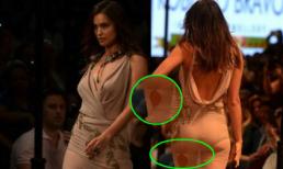 Bồ Ronaldo phản cảm với váy rách toạc vì vòng ba chật cứng