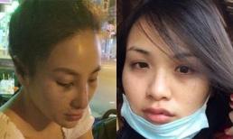 Khi các Hoa hậu là nạn nhân của thói vũ phu, bạo lực