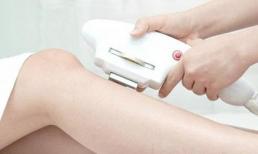 Cơ hội hiếm có triệt lông vĩnh viễn