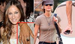 Cận bàn tay 'giun dế' xấu xí của Sao nữ Hollywood