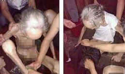 Cụ bà 90 tuổi gầy trơ xương vì bị các con nhốt và bỏ đói