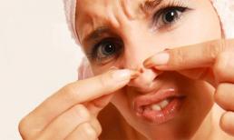 20 cách trị mụn cực nhanh và hiệu quả nhất