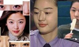 Những bộ phận thẩm mỹ của Sao Hàn