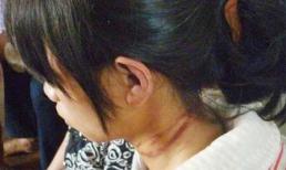 Bị mẹ ruột hành hạ, thiếu nữ uống thuốc tự tử