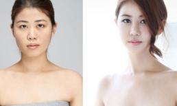 Cô gái Hàn thành hot girl sau khi phẫu thuật mặt và bộ ngực chảy xệ 23cm