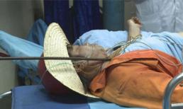 Bị thanh sắt dài 2m xuyên qua người vẫn sống sót