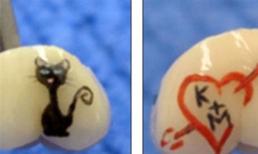 Mốt xăm lên răng của giới trẻ - Đẹp chỗ nào?