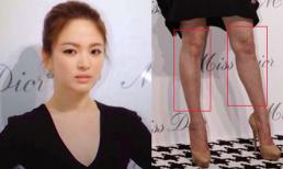 Song Hye Kyo bị soi chân cong và đầu gối "củ lạc" khi xuất hiện ở Thượng Hải