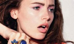 Khắc phục nhanh 7 vấn đề về da bạn hay gặp nhất vào mùa hè