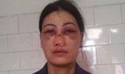 Sự thật vụ "chồng bắt vợ ăn phân lợn, đánh vợ biến dạng khuôn mặt"