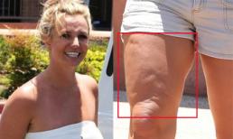 Britney Spears lộ chân lồi lõm bều nhều mỡ