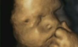 Bất ngờ với hình ảnh thai nhi suy tư trong bụng mẹ