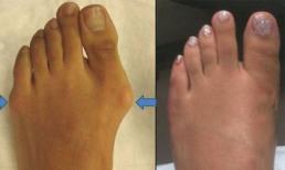 Những phương pháp phẫu thuật thẩm mỹ đáng sợ nhất của phái đẹp