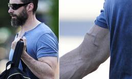 Nam tài tử Hugh Jackman lộ đôi tay nổi gân 'giun dế'