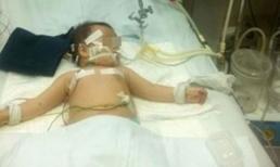 Uống nhầm dầu đựng trong chai nước ngọt, bé 1 tuổi nguy kịch