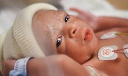 Bs. Phạm Văn Hùng: Những lưu ý đặc biệt khi chăm sóc trẻ sinh non