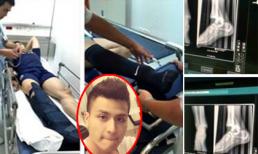 Fan xót xa vì Vĩnh Thụy bị gãy xương chân rất nặng