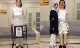 Cuộc sống của cô gái 17 tuổi 2,13 m - cao nhất thế giới 