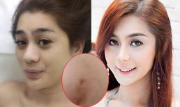 Lâm Chi Khanh khoe mặt mộc đen sạm và bị nghi cắt cánh mũi