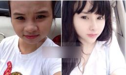 Gặp cô gái Hà Nội với màn lột xác kinh ngạc sau phẫu thuật thẩm mỹ