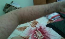 Thiếu nữ rạch tay chi chít khiến dân mạng giật mình